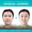 내건강맞춤케어 | 고운빛깔에스테틱 대구점 내 피부 고민 싹 해결해준 맞춤 케어 솔직 후기