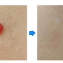 노박젠틀브이의원 이미지