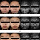 Whitening Function of TCM medicine 이미지