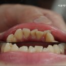 서울에이치과의원 이미지