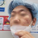 박꽃화장품 | [공지] 안산 피부 관리, 아토피 장벽 관리와 슈퍼젝션 엑소좀으로 극복