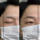 대전눈썹문신 블랙펄 자연눈썹 완성 후기