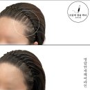 마음에점을찍다두피SMP 이미지