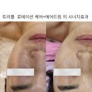 북구 침산동 고성동 칠성동 얼굴주름완화도움케어 촉촉한수분감 탄력집중관리