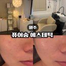 원주 무실동 피부관리 퓨어숲에스테틱 베스트 관리 후기