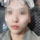 잠실 피부관리, 필관리 물광관리 후기 예스뷰티