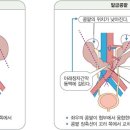 소문난내과의원 네이버블로그