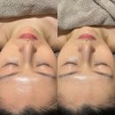 수영로 711 복합건물 | [남천동 에스테틱] 리쎄 드 스파에서 맞춤 스킨부스터 관리 받고 온 후기