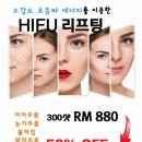 고감도 초음파 리프팅 시술 (HIFU) 이미지