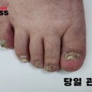 레푸스 사상점 이미지