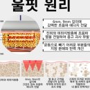 [청담피부과 엠레드] 튠바디 허벅지 리프팅 솔직후기