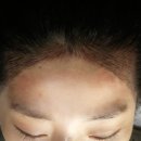 수헤어라인 이미지