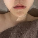 봉담 하이푸 리프팅 관리받고 온 솔직후기, 드봉에스테틱