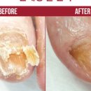 네일 수 이미지