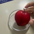 세븐일레븐 부산광혜병원점 | 이렇게 아파본 적이 없는 사람인데 : 난소 물혹 수술 후기