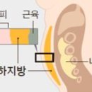 팔층피티