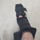 교통사고후 아킬레스건 완전 파열… 수술 후 재활 과정 기록 이미지