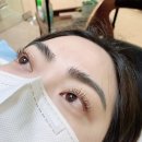 문정동속눈썹 페이스라인 다녀온후기