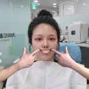가이드 플란트 치과 의원 _ 스케일링, 충치 발치 신경...마취 진료 및 치료 후 정기검진 후기 일지 기록