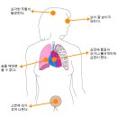 당뇨 / 무서운 고혈압 ! 혈압에 좋은 습관 과 음식 이미지