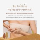 안흥한의원 | 수유후 처진 가슴리프팅에 좋은 가슴매선침으로 안전하게