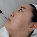 5205 | 강서구 에스테틱 마곡 여드름관리 피부시대 마곡 에스테틱 재생관리 잘하는곳 7탄 내돈내산 솔직후기
