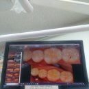 로덴메트로치과의원 이미지