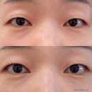 229 | 별내속눈썹펌) 경춘선/8호선 접근성좋은 필인뷰티 방문후기:)