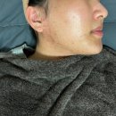 씨유 위례광장점 | 위례피부관리 끌로제에스테틱 재방문 콜드플라즈마 내돈내산