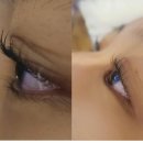 순수스킨케어 이미지