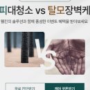 웰킨 두피탈모센터 둔산점
