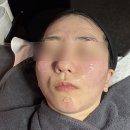 부안중학교 | [후기] 안양피부관리 솔에스테틱 안양평촌점_여드름 솔루션 케어