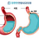 장편한내과의원 네이버블로그