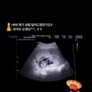 [임신15-16주]산후조리원 계약/일상유희 초음파 앨범/아들맘 진짜_최종_확정.jpg/삼성카드 베이비키트