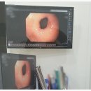풍암동내과 풍암탑내과에서 국가건강검진(위내시경) 받은 후기랑 주의사항/저녁7시까지진료