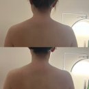 송도 에스테틱 비주안 거북목 관리 후기