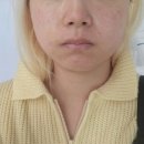 고운로 | 서산 피부관리 :: 서산 박앤이 여드름관리 후기