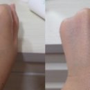 에이스킨(a skin)