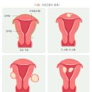 하연옥산부인과의원 | [하연옥 산부인과] 초음파, 자궁경부암 검사 후기