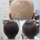 김호증모가발앤행복헤어샵 | 대구 항암가발 희망과 따뜻함을 전하는 맞춤
