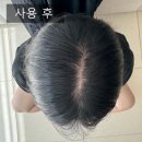 나는야 환경지킴이 | 우리가족 탈모지킴이 큐어블 스칼프 에니그마 탈모완화 샴푸 찐사용후기