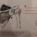더팔페이션