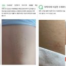 피부에 나타난 ‘육각형 무늬’의 정체는? 이미지