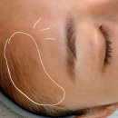 온유뷰티헤어 | [월평동 온유뷰티] 극건성+아토피 피부 여자의 헤어라인, 눈썹왁싱 시술 찐후기!