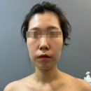 이대역 | [이대역] 이대피부관리 &#34;모비디크뷰티&#34; 솔직후기 / 스킨부스터,ERM,데콜테 관리 추천
