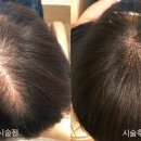 더모어 이미지