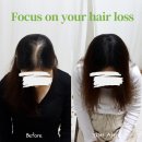 나는 소년이었다 SMP 이미지