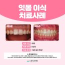 나유치과의원 네이버블로그