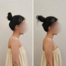 Body Atelier | 울산 피부관리 남구 삼산동 아뜰리에드스킨 신부관리 라운드숄더관리