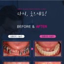 서울니어치과 이미지